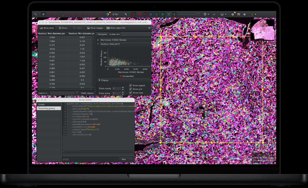 MacBook Pro, QuPath, muestra de tejido teñido con fluorescente en rosa, morado y verde, panel de Escritor de Scripts con código, tabla de detecciones que muestra las mediciones del diámetro del núcleo, gráfica de dispersión